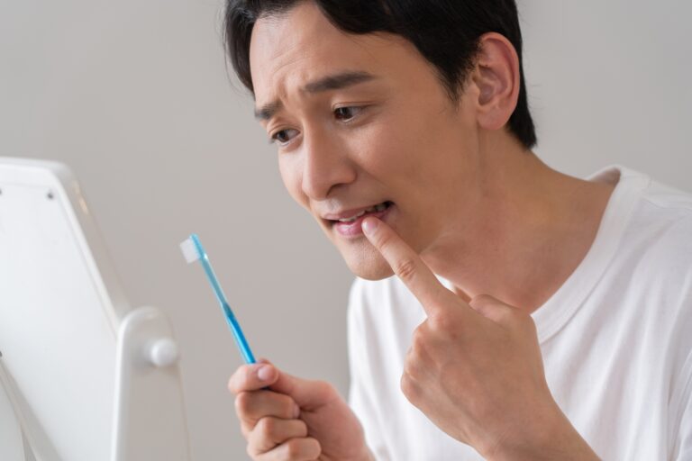 抜歯後の過ごし方は？いつまで痛みが続くかや、治るまでの期間も解説